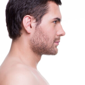 Rinoplastia masculina